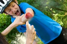 Akutol – ochranný plastický obväz v spreji 60 ml